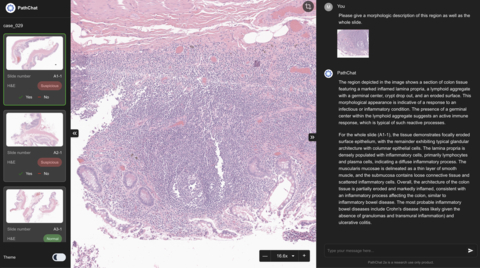 PathChat 2a (research use only) is capable of patch, slide and case level reasoning. (Graphic: Business Wire)