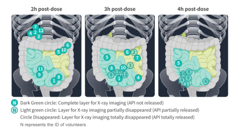 thumbnail X-ray imaging results of D23 (Budesonide Ileum Targeted Tablet) (Graphic: Business Wire)