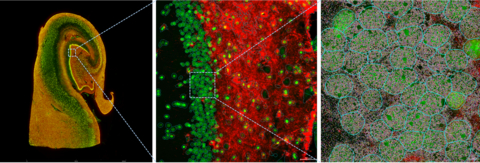 RNA transcripts in human hippocampus FFPE tissue assayed with the CosMx Whole Transcriptome Panel (Photo: Business Wire)