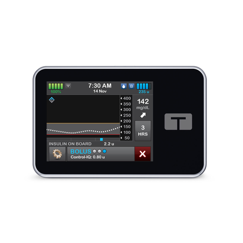 The t:slim X2 insulin pump with Control-IQ+ technology from Tandem Diabetes Care. (Photo: Business Wire)