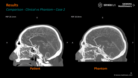 Stratasys and Siemens Healthineers Bring a New Era for Medical Imaging Research With Patient-Specific 3D-Printed Phantoms (Photo: Business Wire)