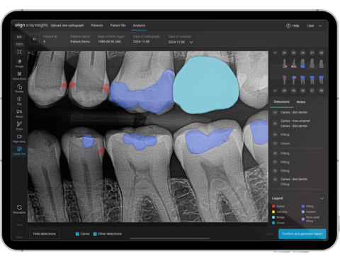 thumbnail Align X-ray Insights, an AI Computer-Aided Detection Software (Photo: Business Wire)
