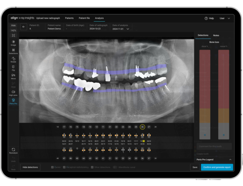 original Align X-ray Insights, an AI Computer-Aided Detection Software (Photo: Business Wire)
