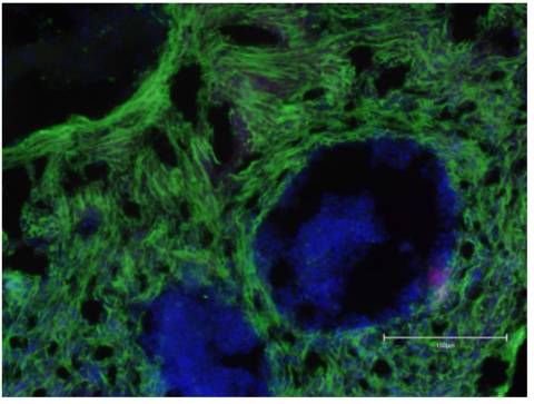 Image caption: Cellino generated iPSC transformed by Matricelf into functional neural tissue (Photo: Business Wire)