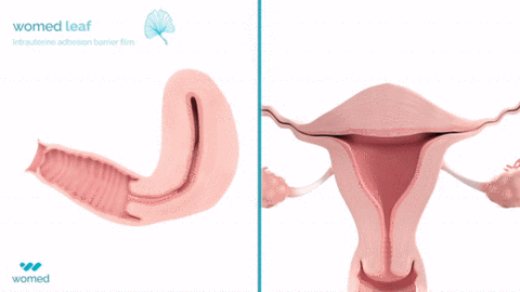 original Womed Leaf mode of action