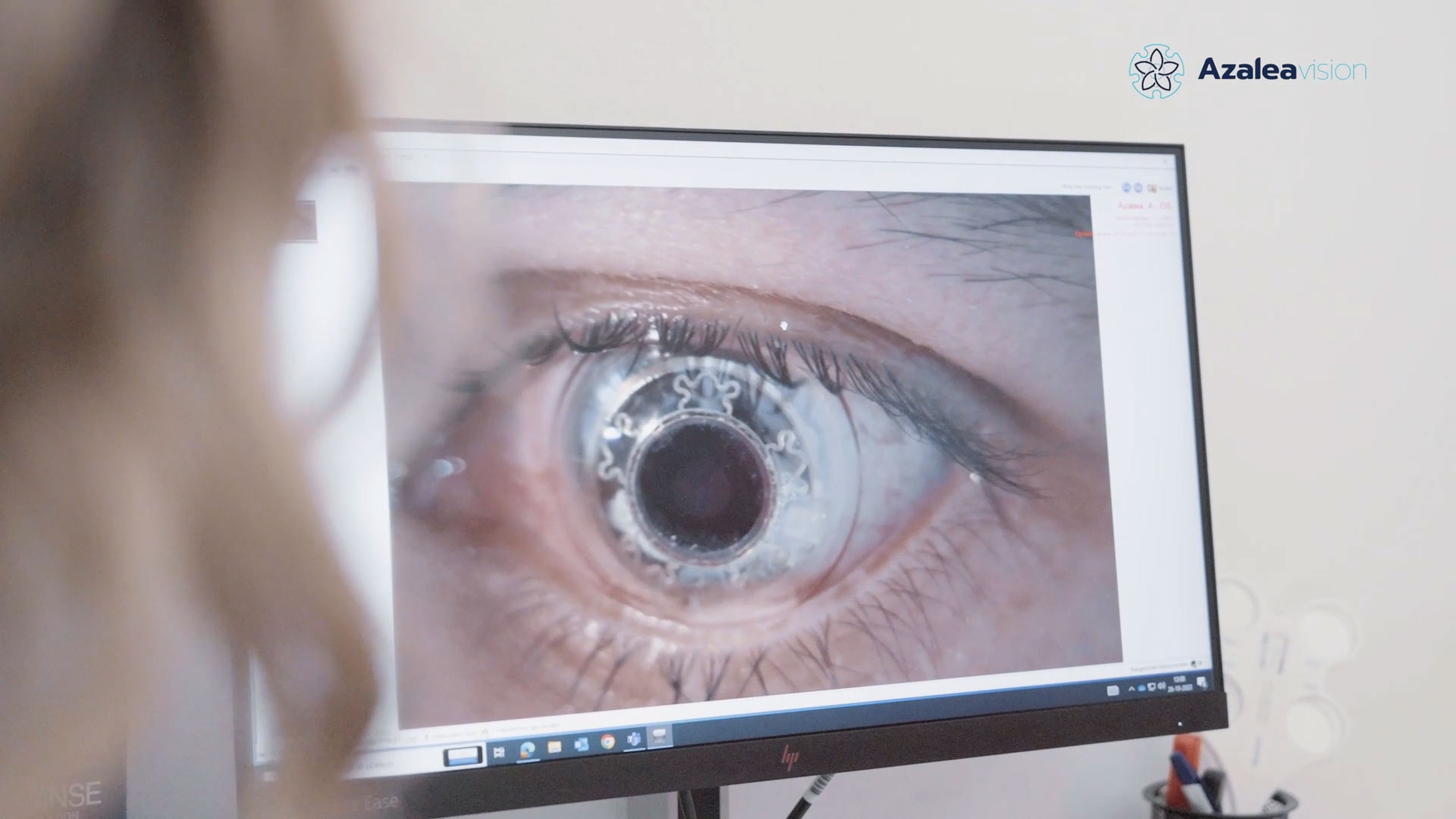 thumbnail Smart Lens Testing