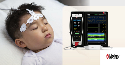 original Masimo SedLine® Brain Function Monitoring