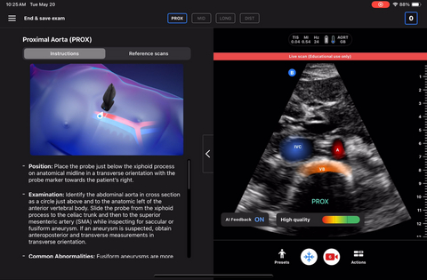 original Butterfly Network Advances AI-Powered Aortic Valve and Aorta Screening with New Research and Training Tools