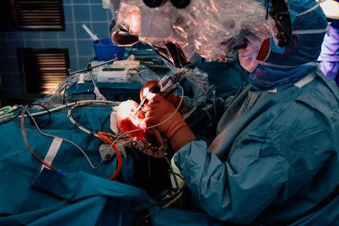 original Figure 1. MARGINUM® intraoperative aspirate tissue monitoring device (HIVEN®) was used at Nordic hospitals during clinical trials. The device is positioned on the instrument table next to the surgeon.