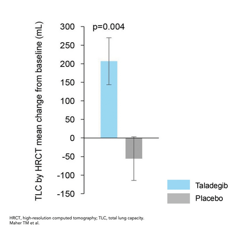 thumbnail The mean change from baseline to week 12 in TLC improved significantly for the taladegib group (206.67 mL; 95% CI, 82.63 to 330.70 mL) but decreased for the placebo group (–55.58 mL; 95% CI, –170.71 to 59.55 mL) resulting in a significant between-group change from baseline to week 12 in TLC of 257.0 mL (95% CI, 86.8 to 427.2 mL; p=0.004).