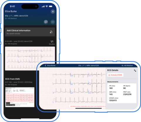original Real time access to all ECGs enables ED Physicians to request IC review of acute coronary syndrome cases before STEMI team activation, eliminating false activations and middle-of-the-night disruptions