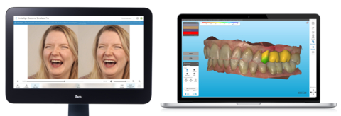 original Series of new features enable patients to see their comprehensive oral health condition and potential future Invisalign® smile through dynamic visuals at chairside on an iTero™ scanner.