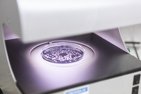 Syngenta and Amoeba SA to develop and commercialize biocontrol solutions for EU and UK