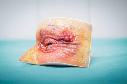 original Anatomic models, like the one shown, are being created and used for advanced surgical education, training and surgical planning to boost the skill sets of medical professionals and improve patient outcomes.