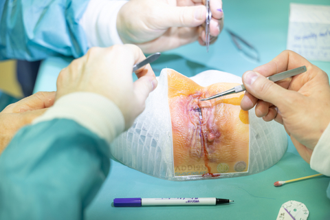 thumbnail Anatomic models, like the one shown, are being created and used for advanced surgical education, training and surgical planning to boost the skill sets of medical professionals and improve patient outcomes.