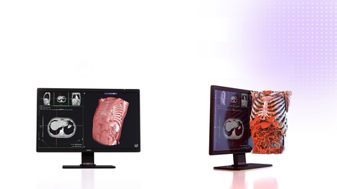 Photo Credit: Avatar Medical