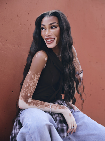 Winnie partners with Incyte to raise awareness of vitiligo