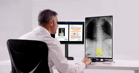 Medimaps Group's new AI-powered software TBS Reveal*