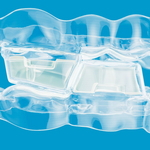 Mandibular_Advancement_with_Occlusal_Blocks.jpg