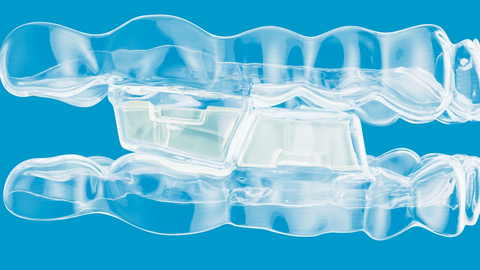 The Invisalign® System with mandibular advancement featuring occlusal blocks is the latest clinical innovation that expands Align’s Class II treatment portfolio for growing patients by offering practitioners a comprehensive solution for treating growing patients with Class II malocclusions caused by mandibular retrusion.