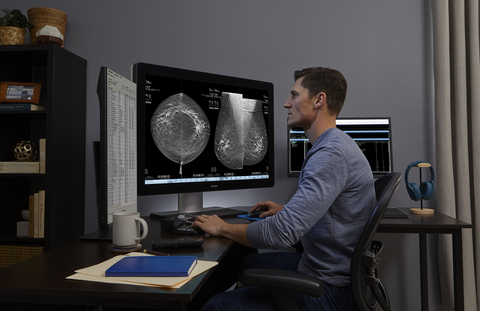 Hologic's AI-Powered Mammography Technology