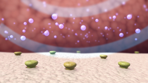 original Surf plans to leverage a patented broad beam ultrasound platform that sends gentle acoustic energy into the body designed to safely activate the nerves.