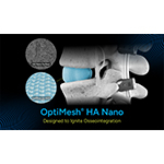 OptiMesh_HA_Nano_PR.jpg