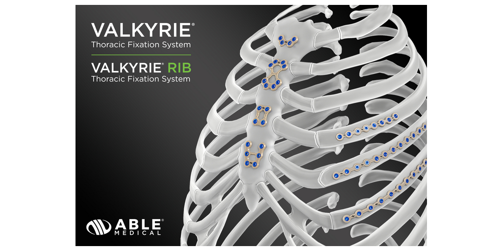 Over 10,000 Procedures Completed in U.S. with Valkyrie® Thoracic Fixation System 1 Valkyrie Sternum SternandRib Glam2026