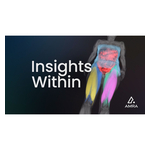 amra-insights-within-scan-screen-logo-PR_Video.jpg