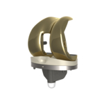 TJO Surpasses 50,000 Implants Placed, with 32% of Procedures Performed in ASCs 2 Klassic Knee Aurum Assembly