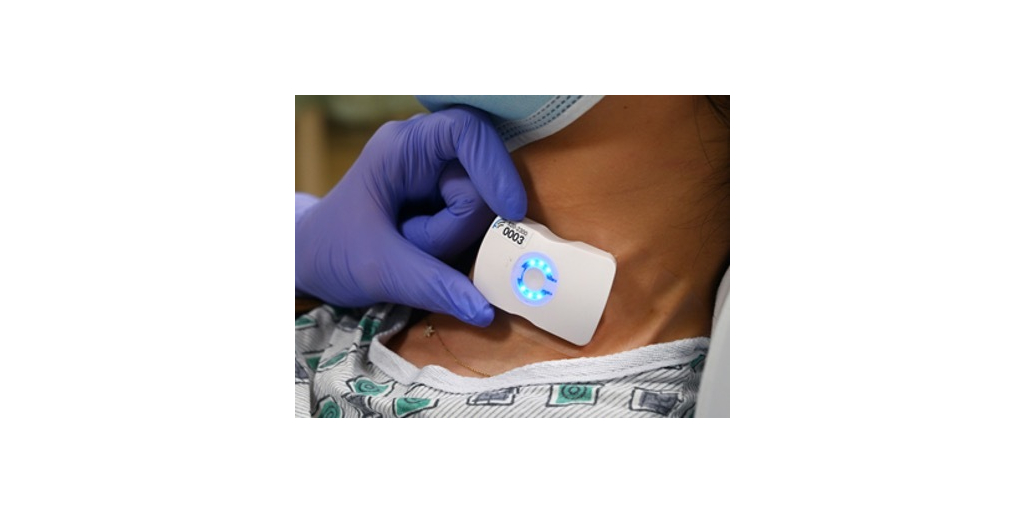 Flosonics Medical Receives Vizient Innovative Technology Contract for FloPatch Wearable Doppler Ultrasound 1 FloPatch image