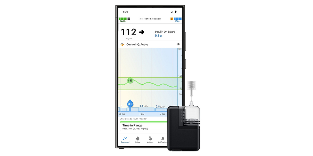 Tandem Mobi Now Compatible with Android Smartphones 1