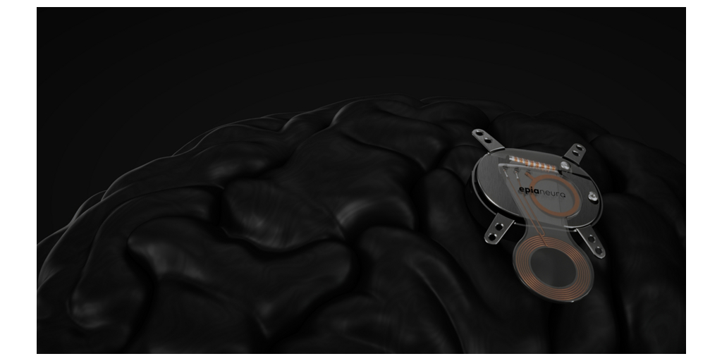 Epia Neuro Launches to Develop Intent-Driven Neural Technology to Restore Function After Stroke and Address Cognitive Decline 1 EpiaNeuro Device