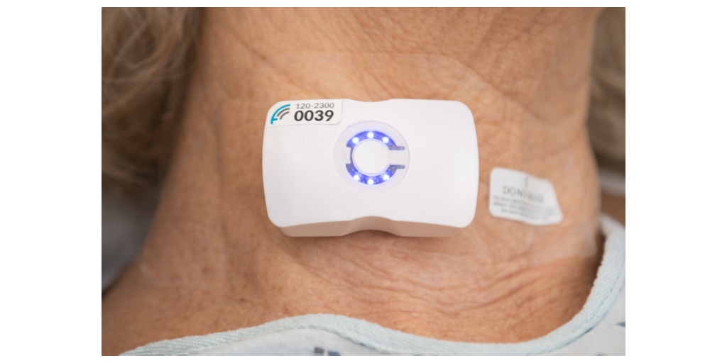 Sutter Health Expands Use of Wearable Ultrasound Tech Across Additional ...