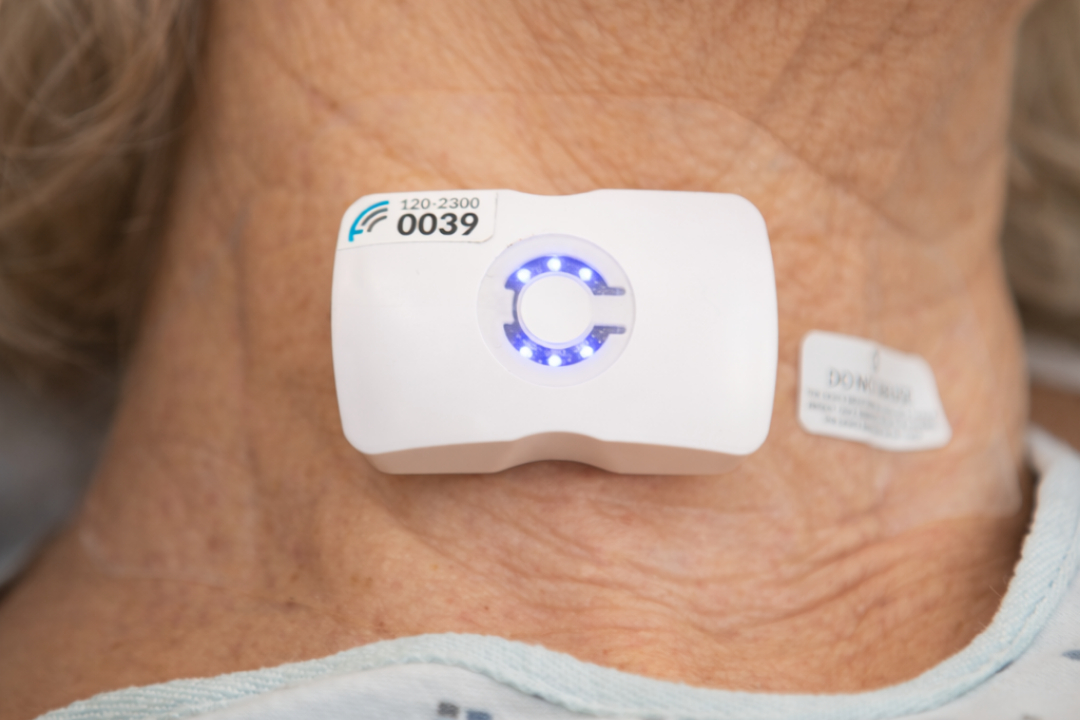 Sutter Health Expands Use of Wearable Ultrasound Tech Across Additional ...