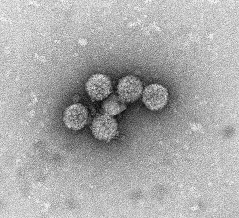 Electron microscope image of BK virus, showing the VP1 capsid protein that creates an icosahedral shell around the viral genome.