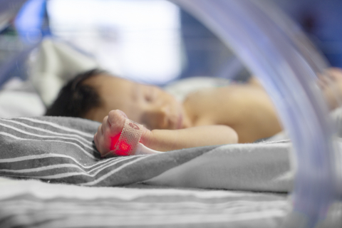 Masimo RD SET® Neo Pulse Oximetry Sensor