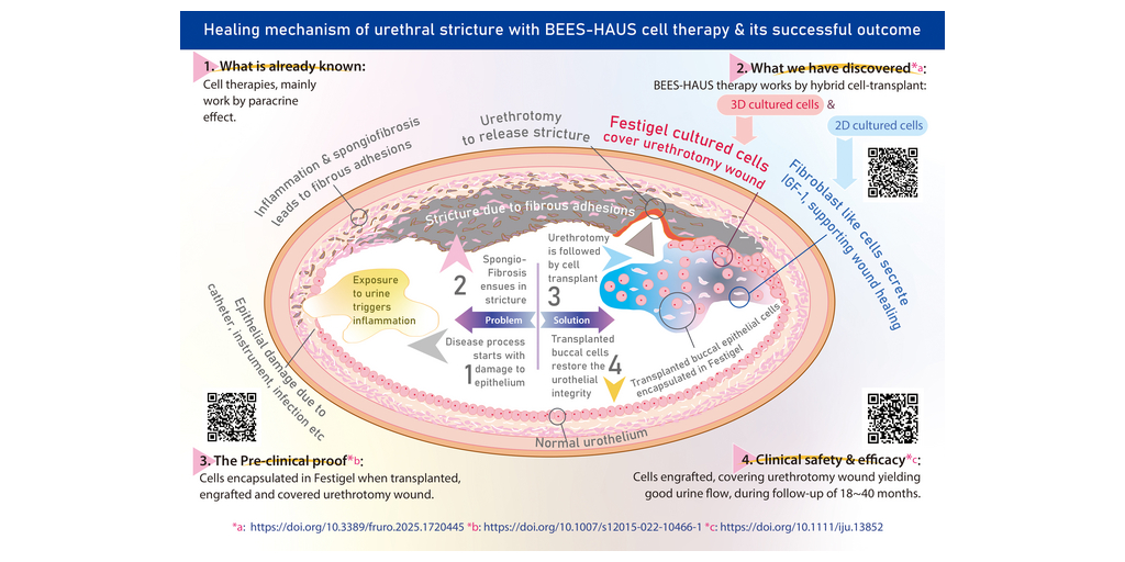 Pioneering feat in regenerative medicine, the BEES-HAUS cell therapy: Paracrine effect and cell engraftment, together healing urethral stricture. Its simplified version, BHES-HAUS’ results to be presented in AUA 2026 1 GNC PR 91 2020 21 Bees Haus 2D 3D cell engraft BW Ill v1 4 20feb26