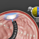 MOVIVA_GMA_Ablation.jpg