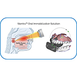 Stentra_Oral_Immobilization.jpg