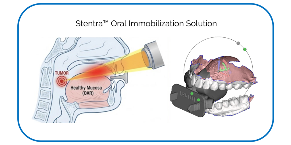 Kallisio Stentra™ Named “Best New Radiology Technology Solution” in 2026 MedTech Breakthrough Awards Program 1 Stentra Oral Immobilization