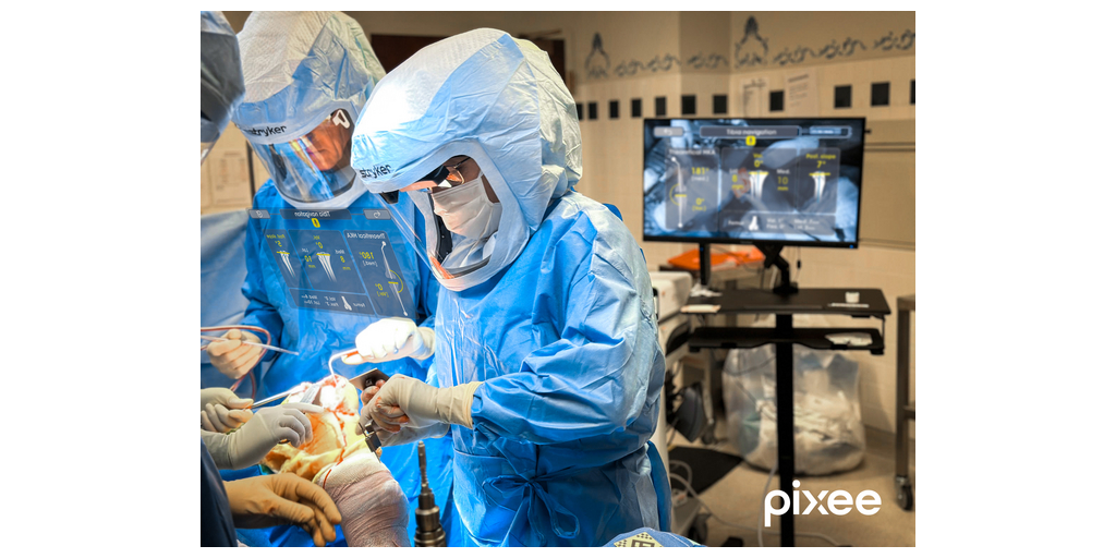 Augmented Reality Enters a New Phase: Michigan Surgeon Performs First U.S. Knee Replacement Using Pixee’s Knee+ NexSight Smart Glasses 1 DR KASSAB