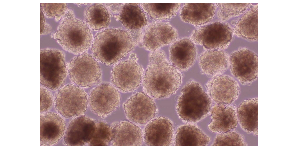 Heartseed, World's First Clinical Trial of Catheter Administration of iPSC-Derived Cardiomyocyte Spheroids: First Patient Dosed