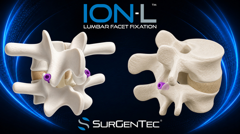 original SurGenTec® Receives FDA Clearance for ION-L™, a Novel Lumbar Facet Fixation System Representing a Paradigm Shift in Minimally Invasive Spine Surgery