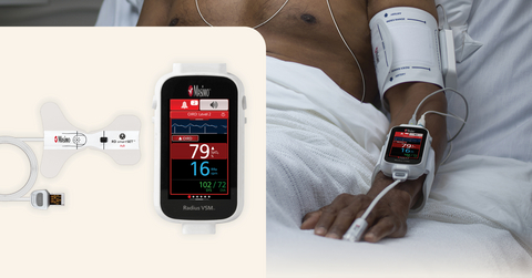 original Opioid-Induced Respiratory Depression Detection with Masimo smartSET™ and Radius VSM®