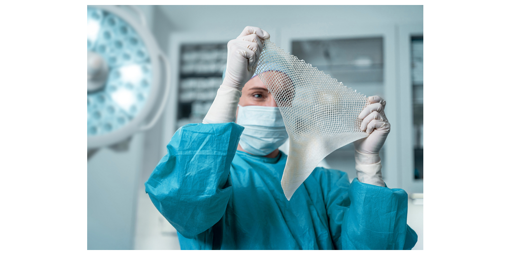 Kerecis Expands Insurance Coverage for Fish-Skin Grafts - 40 Million Covered Lives Added 1 GraftGuide Meshed 2to1 Clinic C