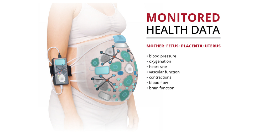 Carnegie Mellon Team Awarded ARPA-H Contract to Transform Care During Labor and Childbirth 1 APPROVED OMEGA ARPAH CMU Graphic