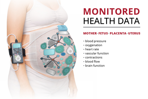 original Carnegie Mellon University is leading a multi-university team that has secured an award of up to $39.3 million from the Advanced Research Projects Agency for Health (ARPA-H) to develop a wearable monitoring system to better identify fetal distress and its cause, enabling a safer labor and delivery experience for mothers and babies.