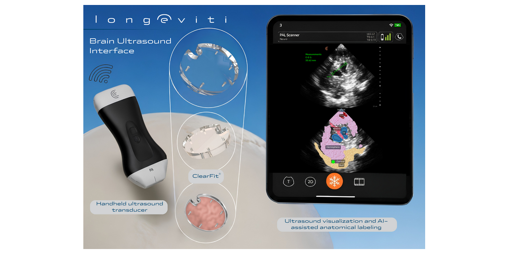 Longeviti Launches ClearFit AI™, a Brain Ultrasound Interface (BUI) to Advance Platform Solutions for Neurological Disorders 1 Picture1