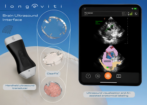 original ClearFit AI, a Brain Ultrasound Interface (BUI).